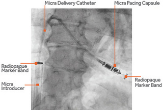 Image: Medtronic
